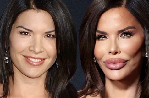 Lauren Sanchez Plastic Surgery Then and Now Revealed