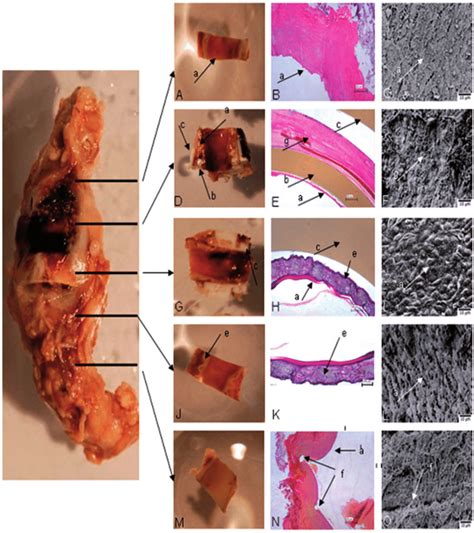 Investigation Of The Explanted Specimens Specimens Were Divided And