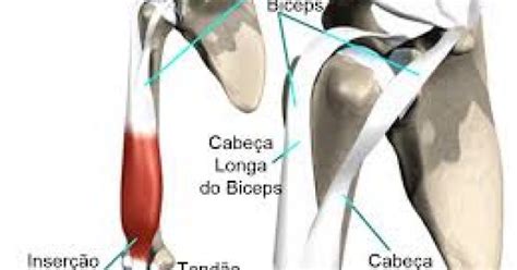 O Que A Tendinite Do B Ceps Pacientes Do Dr M Rcio Silveira