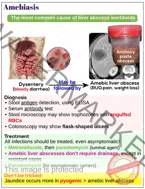 Entamoeba Histolytica Amebiasis Medicine Keys For Mrcps