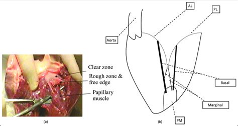 Mitral Valve Chordae Tendineae A Subvalvular Apparatus View Of The