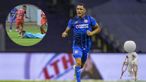 As Fue La Escalofriante Lesi N Que Sufri El Ex De Cruz Azul Yoshimar