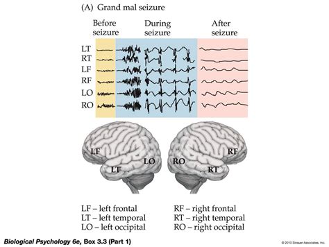 Life After Being A Student My Mission To Learn Neurological Diseases