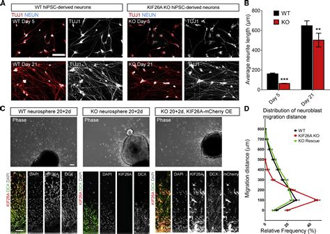 Loss Of Non Motor Kinesin Kif A Causes Congenital Brain Malformations