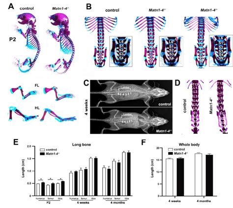 Skeletal Phenotype In Mice Lacking All Matrilins A Skeletal Staining