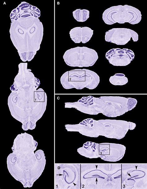 Frontiers The Neuroterrain D Mouse Brain Atlas