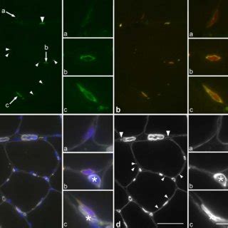 Pax7 staining and myonuclei. Control section from a C subject stained ... 
