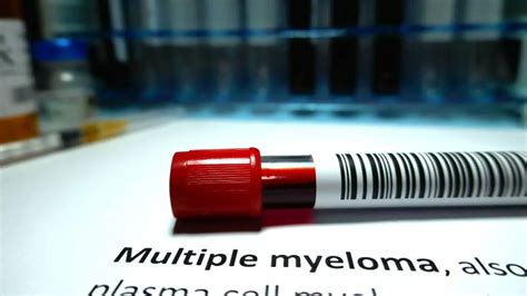 Multiple Myeloma Subtle Signs Of The Disease You Should Know About