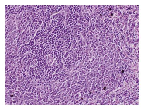 Photomicrographs Of H And E Stained Sections Of Spleen Of The Different