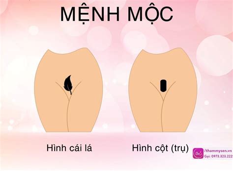 Triệt bikini tạo hình Các kiểu mẫu triệt bikini tạo hình mới nhất