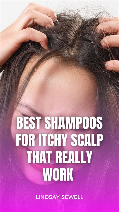 Shampoos For Itchy Scalp That Really Work Artofit