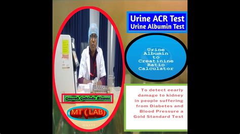 What Is Urine Acr Test Urine Microalbumin Creatinine Ratio Principle