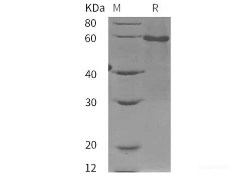 Quality Reliable Recombinant Human Amh Protein His Tag Pdeh At