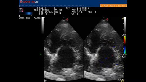 Mitral Valve Disease Timeline Of A Degenerative Condition In Dogs