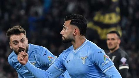 Lazio Le Condizioni Degli Infortunati E I Tempi Di Recupero