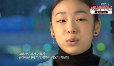 블라인드 스포츠 김연아 쌍수 했어