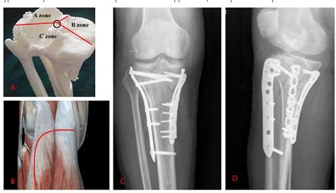 Figure From The Application Of D Printing Technology In The