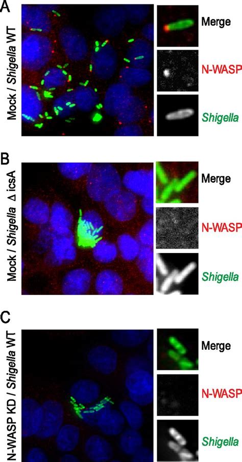 Bruton S Tyrosine Kinase Regulates Shigella Flexneri Dissemination In