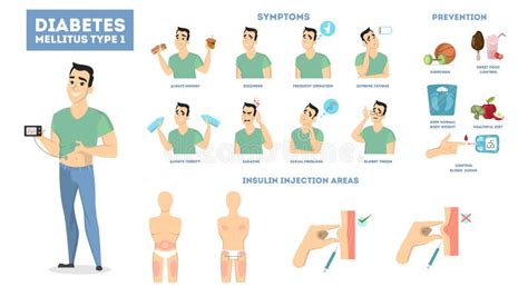 Infografía De Diabetes Síntomas Factores De Riesgo Prevención Y