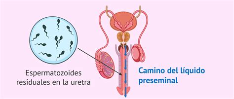 Qué probabilidad hay de quedar embarazada con el líquido preseminal