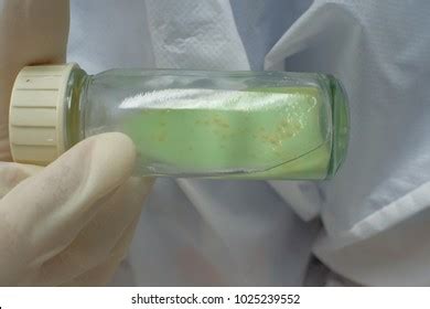 57 Colonies mycobacterium tuberculosis Images, Stock Photos & Vectors | Shutterstock