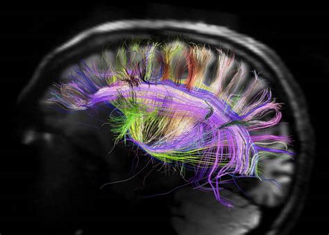 El Cableado Neuronal Se Enreda En Estructuras Cruzadas