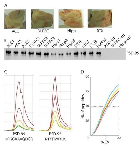 Regional Psd 95 Affinity Purification Of Human Brain Homogenate Panel