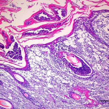 Photomicrograph Of The Skin Of The Bovine Fetus Shown In Figure 1