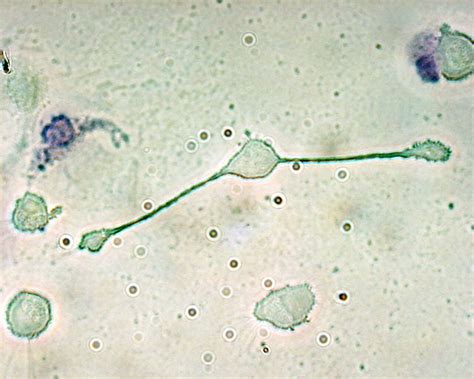 Difference Between Monocyte and Macrophage | Compare the Difference ...