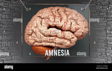 Amnesia Anatomy Its Causes And Effects Projected On A Human Brain