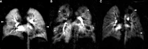 Perfusion MRI is a ready-to-use technique to study functional ...