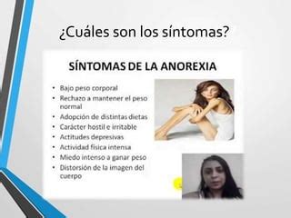 Anorexia Bulimia Obesidad Y Sedentarismo Ppt