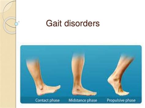 Gait Disorders