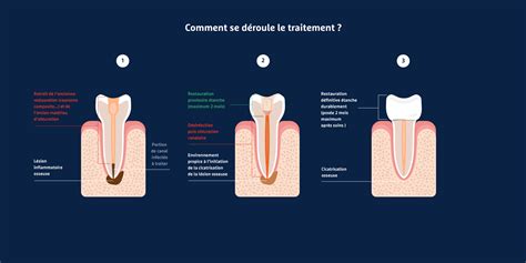 Docteur Anne Charlotte Flouriot Cabinet Endodontie Paris