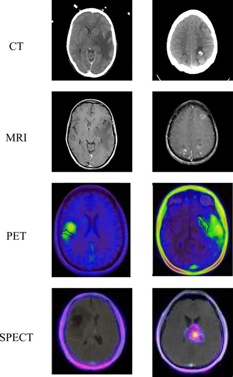 Images Of Different Modalities Download Scientific Diagram