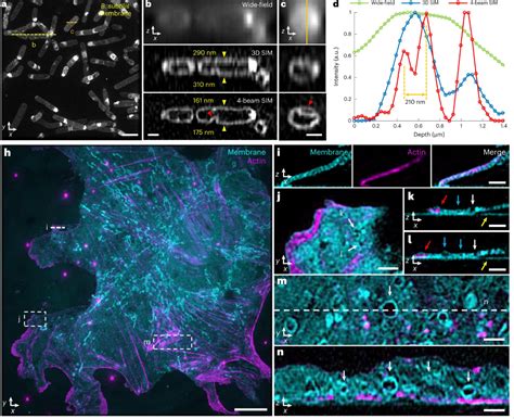 Enhanced Axial Resolution In Three Dimensional Structured Illumination