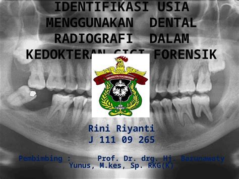 Ppt Identifikasi Umur Menggunakan Dental Radiografi Dalam Kedokteran