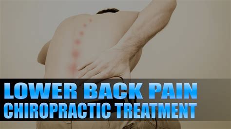 Lower Back Pain Chiropractic Treatment El Paso TX YouTube