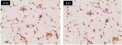 Flagella stain for selected isolates (15, 17) A= monotrichous and ...