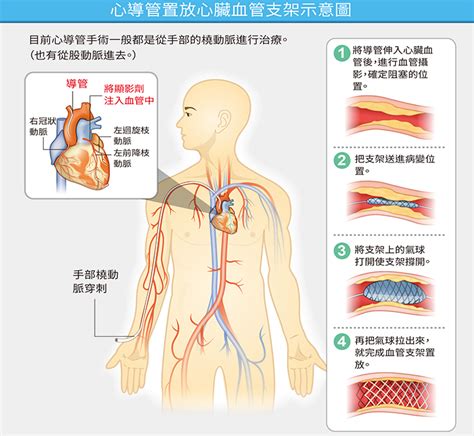 健康刊物 全民健康基金會