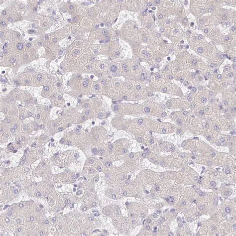 Anti Cxcr Antibody Produced In Rabbit