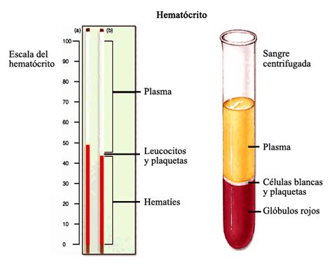 Prácticas Hematología Determinación del valor hematocrito mediante