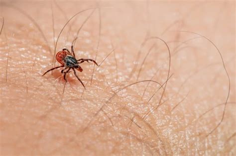 Tackling Tick Infestations A Comprehensive Guide To Tick Pest Control