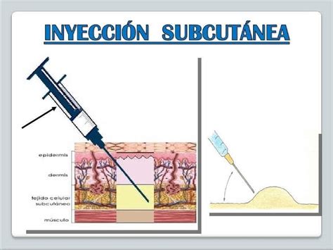 INYECTOTERAPIA By Oscar Espiritu Issuu