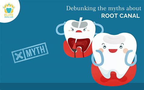 2 Debunking The Myths About Root Canal Elite Dental Care