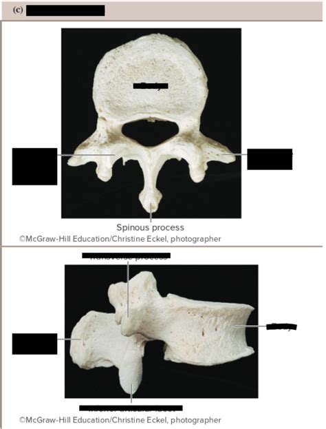 Vertebra Diagram 3 Chpt 7 Anatomy Diagram Quizlet