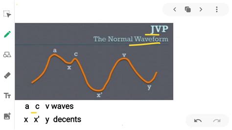 Normal Jugular venous pulse waveform || JVP || Cardiology - YouTube