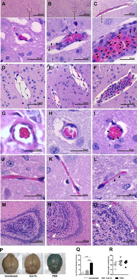 Ext Ts Treatment Decreases Histological Alterations Into The Brain