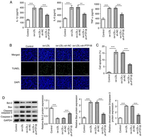 Ptp1b Inhibition Ameliorates Inflammatory Injury And Dysfunction In Ox