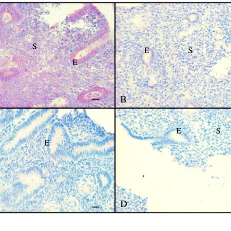 Ab Immunohistochemical Localization Of Vegf In The Endometrium